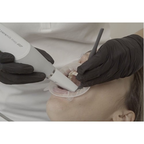 Ceramill® Map DRS