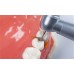 Dental Consumables