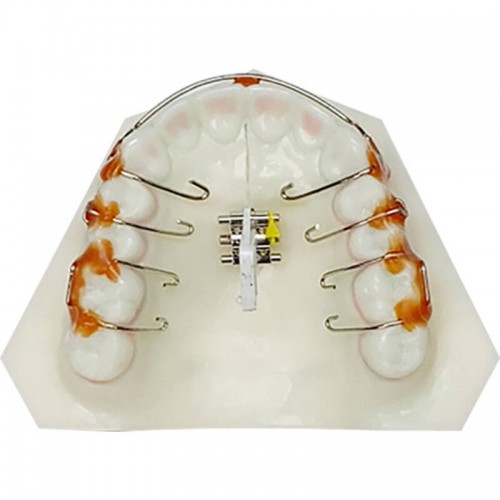 IMPRIMO® Model Separator (100ml)