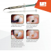 Dental Consumables