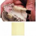 Dental Consumables