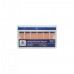 Dental Consumables