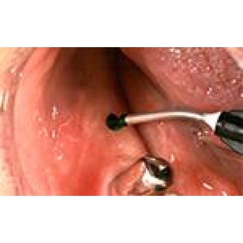 Bio-Ink Flow Sore-spot Indicator Set