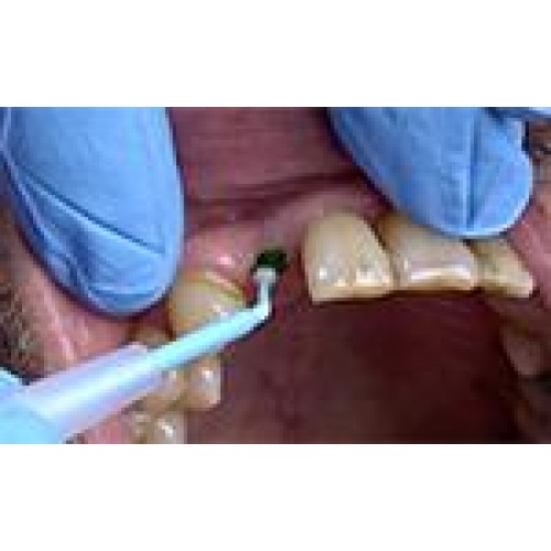 Bio-Ink Flow Sore-spot Indicator Set