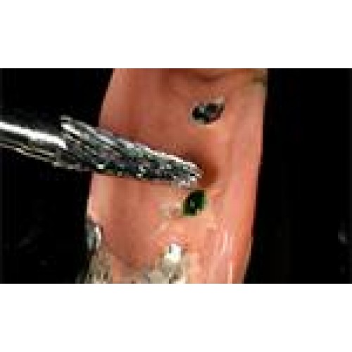 Bio-Ink Flow Sore-spot Indicator Set